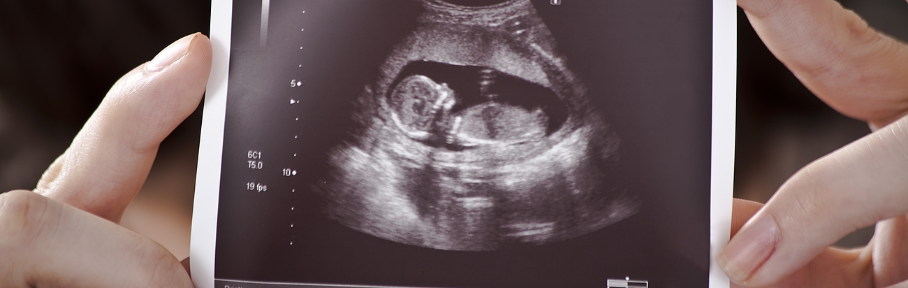 Ultraschallbild eines Embryos